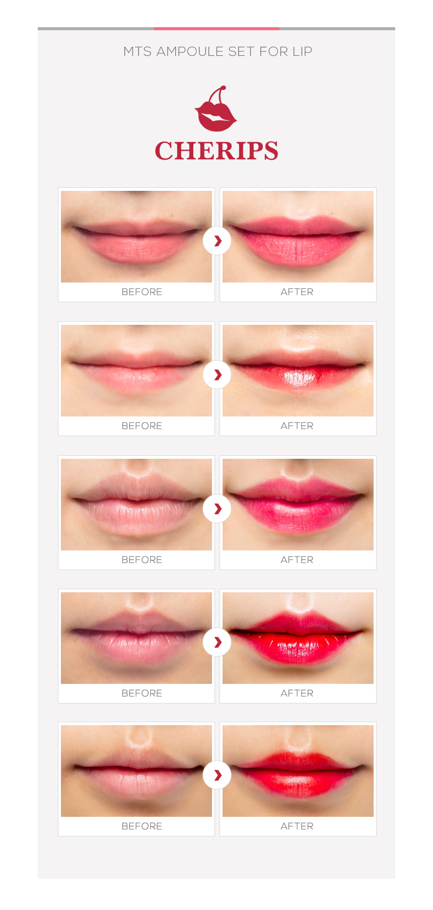cherips before and after