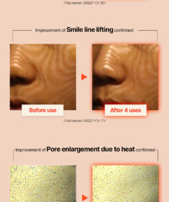 BELDORA V9 PRO-GEN ACTIVATOR_part_01