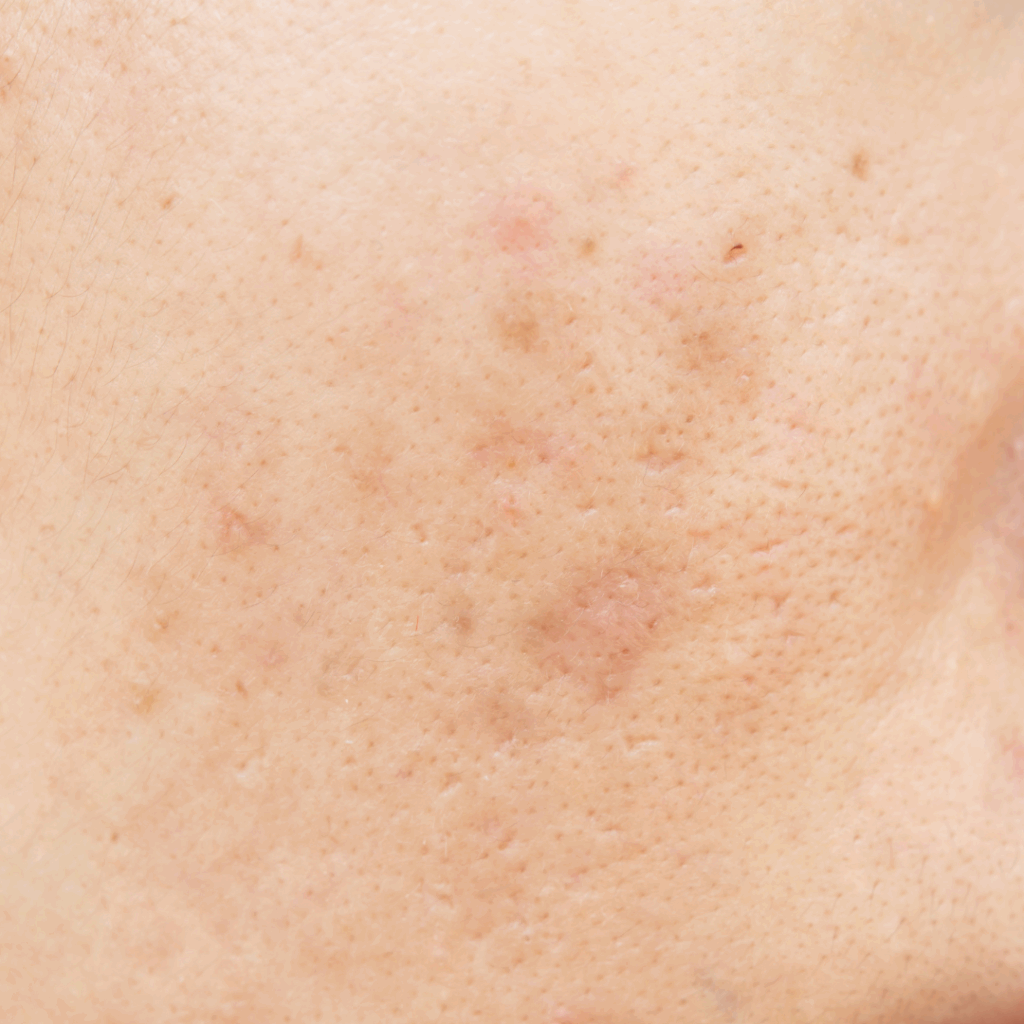 SLOW AGING, Korean skin care, trouble trace remover