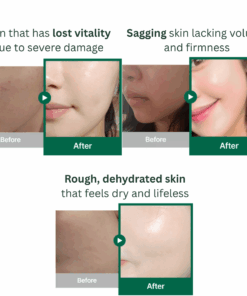 Tender garden Skin Renewal Dual Boosting Serum (90ml) Tender garden Skin Renewal Dual Boosting Serum(90ml) + Condensed Essence (1g) The concentration and stability of Juvel*k’s active ingredients — once impossible to preserve in diluted liquid form — are now fully retained in an effervescent solid formula for 100% preservation. High-Purity 99% PDRN Moisture Regenerating Formula – Water-Glow Tox Serum Daily skincare: After cleansing, spray 2–3 times during the toner step and gently pat for absorption. Your skin will feel clear, hydrated, and comfortably balanced. Intensive care for damaged skin: Soak a cotton pad with the serum and place it on clean skin for about 10 minutes as a soothing and deeply hydrating treatment mask. Tender garden Skin Renewal Dual Boosting Serum Key Ingredients : Camellia PDRN, Exosome, baby collagen, Vitamin E oil